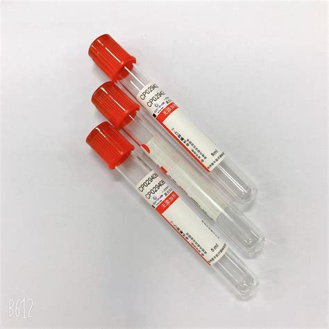 serum separator tube test